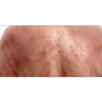 Skin Protective Activity of Consciousness Energy Healing Treatment Based Herbomineral Formulation icon