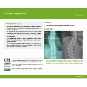 Scolioses congénitales icon
