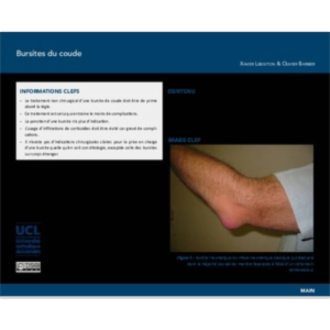 Bursites du coude