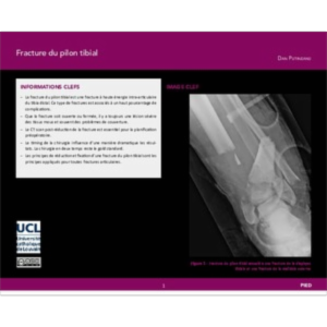 Fracture du pilon tibial icon