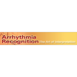 Arrhythmia Recognition: The Art of Interpretation