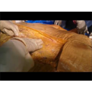 Postural Back Muscle Clinical Aspects - Sanjoy Sanyal icon