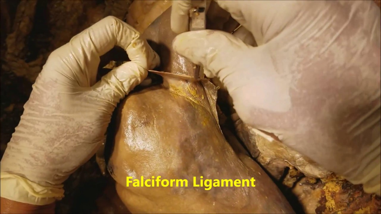 Liver Landmarks-Surgical Fissures-Hepatic Veins Narrative Description – Sanjoy Sanyal icon