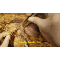 Carotid-Jugular-Vagus-Recurrent Laryngeal Nerve Surgical Dissection - Sanjoy Sanyal icon