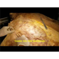 Extrinsic Back Muscle AKA Posterior Girdle Muscle Dissection-Sanjoy Sanyal icon