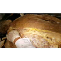 Erector Spinae of Homo Erectus and Accessory Respiratory Muscles -Sanjoy Sanyal icon