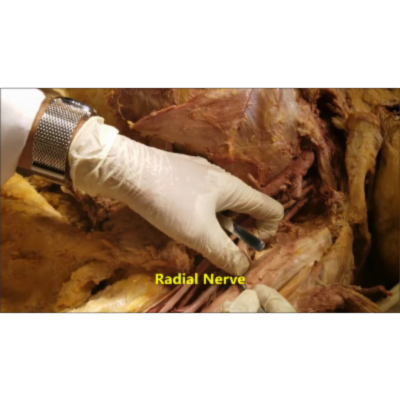 Axilla to Cubital Fossa -Tracing the Neurovascular Structures-Sanjoy Sanyal icon