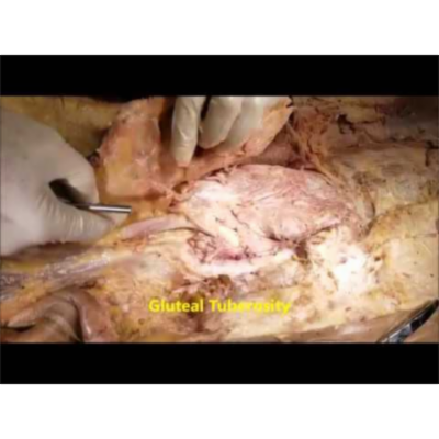 Superficial Glute Muscles Dissection And Trendelenburg Sign-Sanjoy Sanyal icon