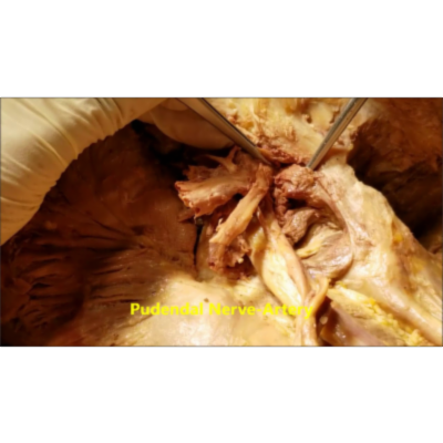 Gluteal-Pudendal Nerves-Vessels And Gluteal Paralysis Description-Sanjoy Sanyal