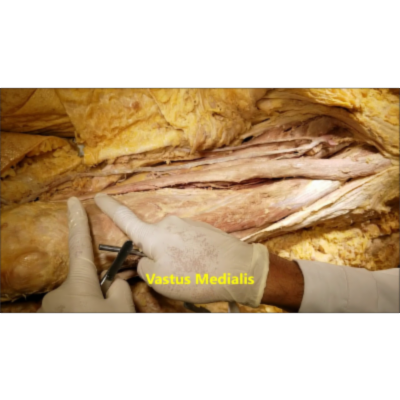 Thigh Anterior Compartment-Quads Dissection - Sanjoy Sanyal icon