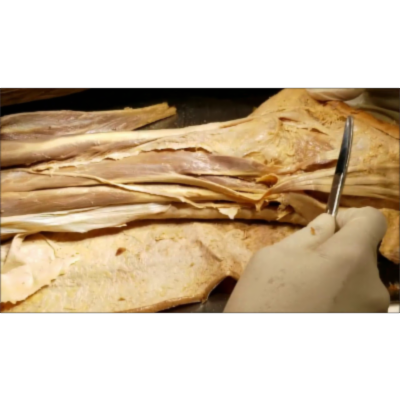 Leg Lateral-Anterior Foot Dorsal Compartment Muscles-DANCER'S FRACTURE - Sanjoy Sanyal icon