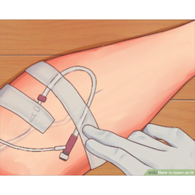 How to Insert an IV icon