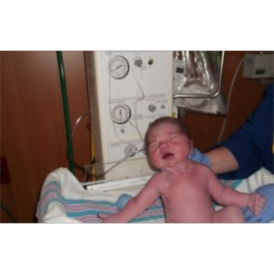 How to Pass Maternity Nursing in Nursing School