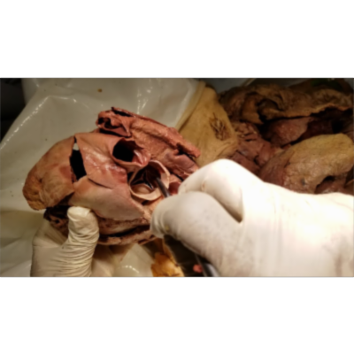 Open Heart Dissection and Narrative Description of its Inner Chambers - Sanjoy Sanyal icon