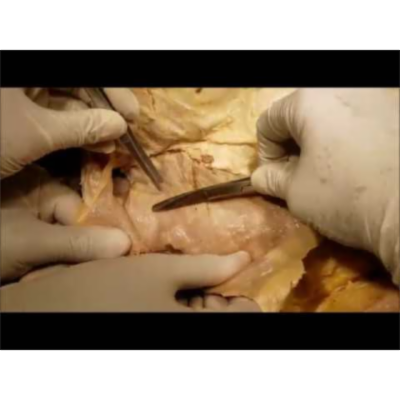 Abdominal Wall-Rectus Sheath-Myopectineal Orifice Dissection-Inguino Femoral Hernias - Sanjoy Sanyal icon