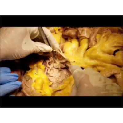 Stomach-Duodenum Peritoneal Spaces-Arteries-Surgical Aspects and Syndromes – Sanjoy Sanyal icon