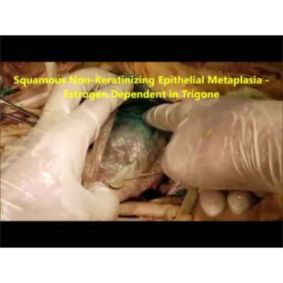 Surgical Anatomy Demonstration of Eviscerated Urinary Bladder – Sanjoy Sanyal icon