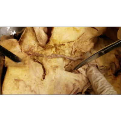 Facial Muscles Dissection – Black Eye – Buccal Fat – Bells Palsy – Sanjoy Sanyal icon