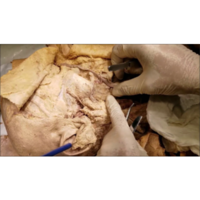 Facial Trigeminal Nerve Distribution of Face–Bells Palsy–Herpes Zoster Ophthalmicus – Sanjoy Sanyal icon