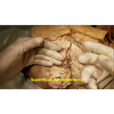 Parotid Gland – Relations Internal Structures and Surgical Anatomy – Sanjoy Sanyal icon