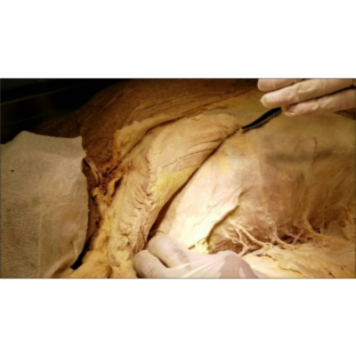 Pectoralis Major-Minor Serratus Anterior and Nerve Supply - Sanjoy Sanyal icon