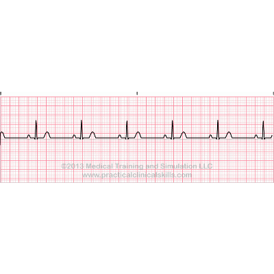 EKG Interpretation Practice icon