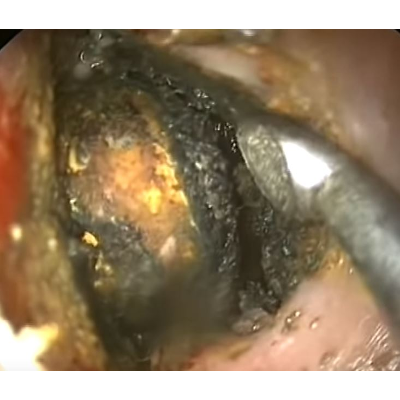 ENT Instruments - Apps on Google Play icon