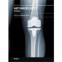 Arthroplasty - Update icon
