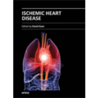 Ischemic Heart Disease