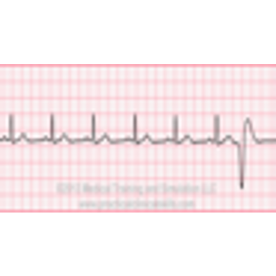 EKG | Electrocardiogram icon