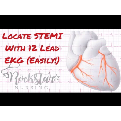 Locate and interpret STEMI based on 12 Lead EKG icon