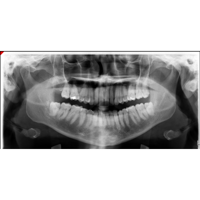 Oral and Maxillofacial Radiographic images icon