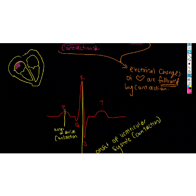 What does the EKG wave series ACTUALLY MEAN?! icon