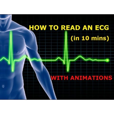 HOW TO READ AN ECG!! WITH ANIMATIONS(in 10 mins)!!