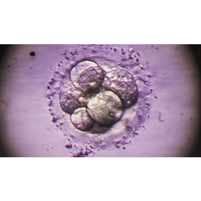 British Scientists Seek Permission To Edit DNA In Human Embryos