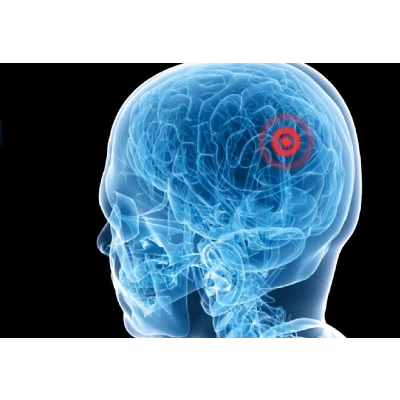 Ultrasound surgery -- healing without cuts icon