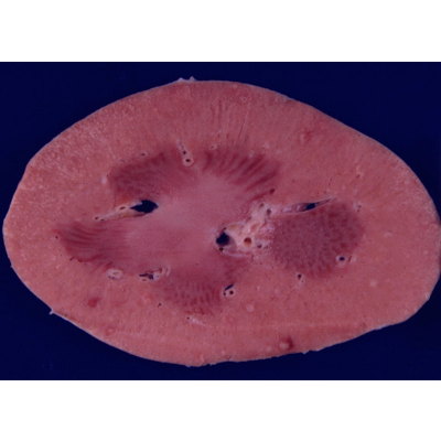 Lesson Two: Urinary System. Renal Pathology icon