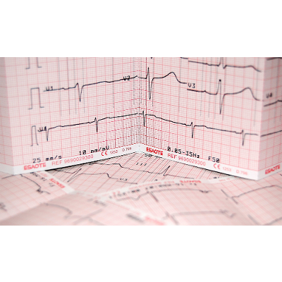 How to Read an EKG Strip in 5 Steps