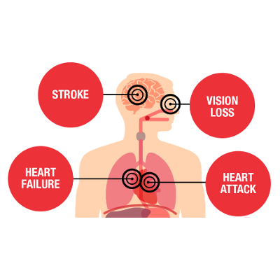 Health Threats from High Blood Pressure icon