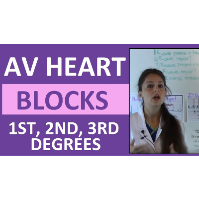 How to Interpret AV Heart Blocks Ekg Heart Rhythms | 1st degree, 2nd degree, 3rd degree difference icon