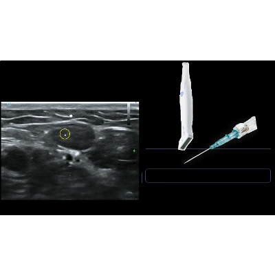 Ultrasound Guided IV Access icon