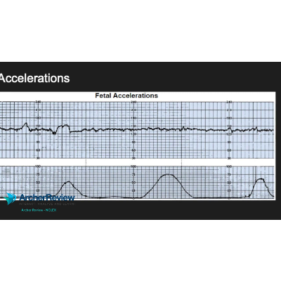 Fetal Heart Monitoring - NCLEX Highyield -Archer