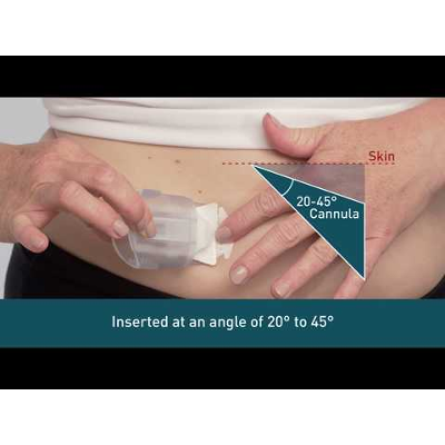 Insulin Pump Infusion Set Training icon