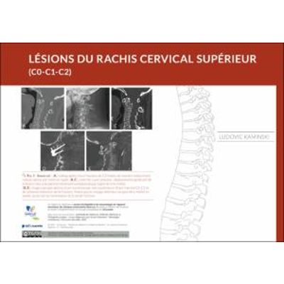 Lésions du rachis cervical supérieur (C0-C1-C2) icon