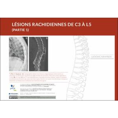 Lésions du rachis de C3 à L5 (Partie 1) icon