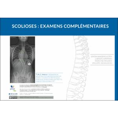 Scolioses : examens complémentaires icon