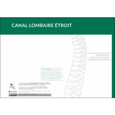 Canal lombaire étroit icon