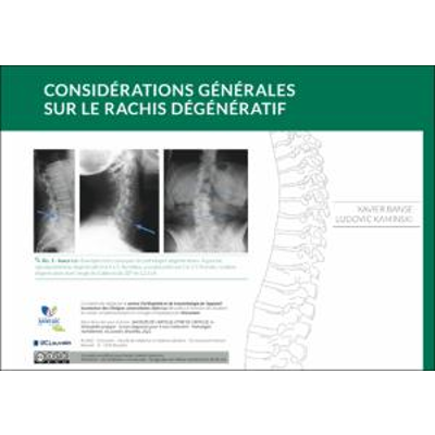 Considérations générales sur le rachis dégénératif icon