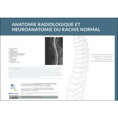 Anatomie radiologique et neuroanatomie du rachis icon