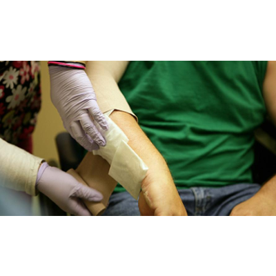 Managing Pain after Burn Injury | MSKTC icon